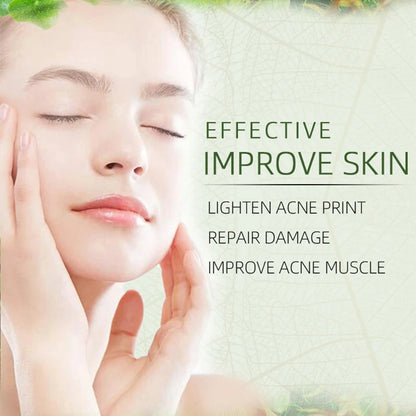 Joypretty Herbal Acne Removal Face Cream against Pimple Remover Ance Treatment anti Ance Moisturizing Repair Damage Skin Care
