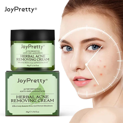 Joypretty Herbal Acne Removal Face Cream against Pimple Remover Ance Treatment anti Ance Moisturizing Repair Damage Skin Care