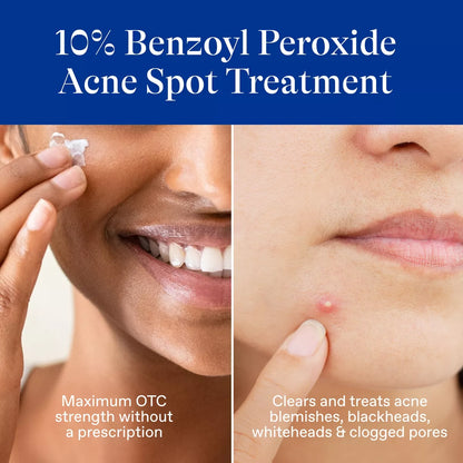 Differin 10% Benzoyl Peroxide Acne Spot Treatment: Hypoallergenic, Facial Treatment, Gel, Acne-Prone Skin
